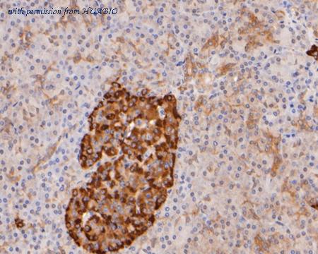 HUABIO ER2001-58 image 3