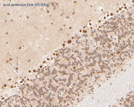 HUABIO ER2001-65 image 2