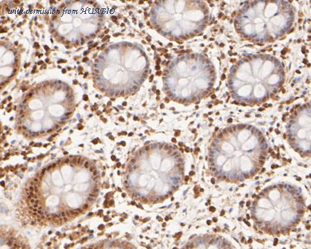 HUABIO ER2001-65 image 3