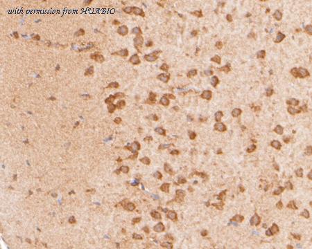 HUABIO ER2001-66 image 2