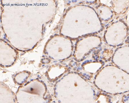 HUABIO ER2001-66 image 3