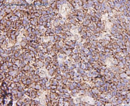 HUABIO ER31203 image 3