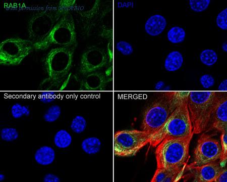 HUABIO ER61098 image 3