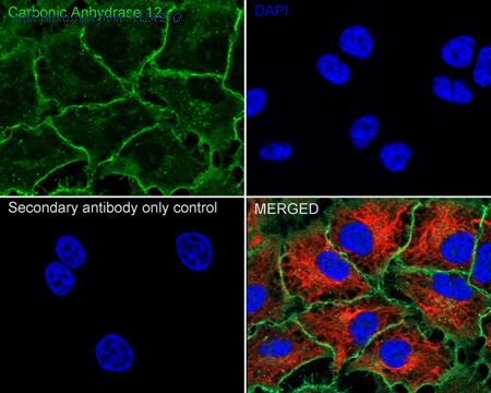 HUABIO ER62856 image 2