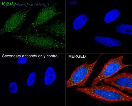 HUABIO ER64000 image 2