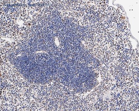 HUABIO ER65765 image 3