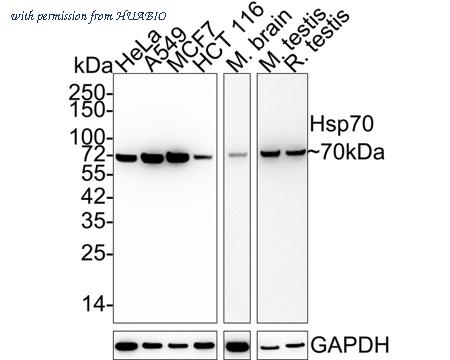 HUABIO ET1601-11 image 1