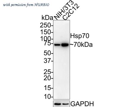 HUABIO ET1601-11 image 2