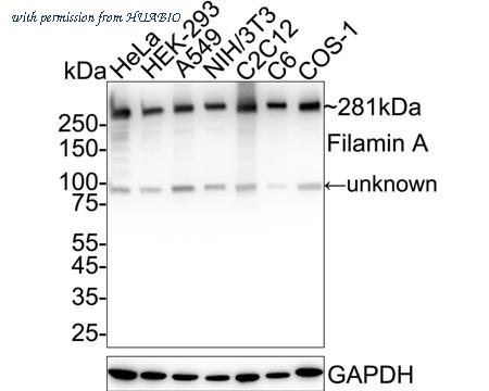 HUABIO ET1601-3 image 1