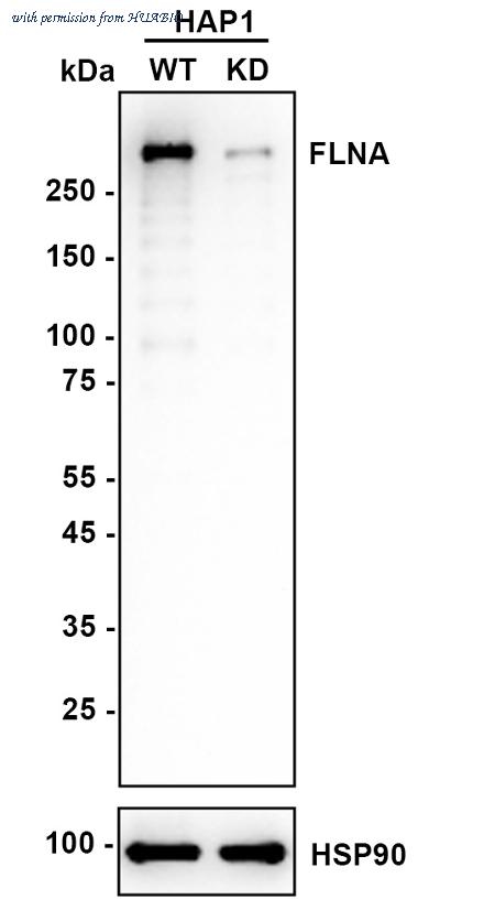 HUABIO ET1601-3 image 2