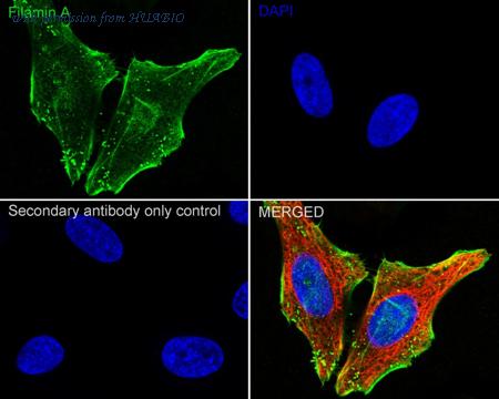 HUABIO ET1601-3 image 3