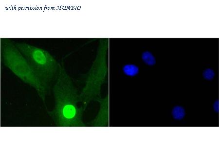 HUABIO ET1602-11 image 2