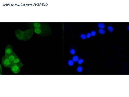 HUABIO ET1602-11 image 3