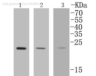 HUABIO ET1602-15 image 1