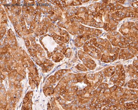 HUABIO ET1602-17 image 3