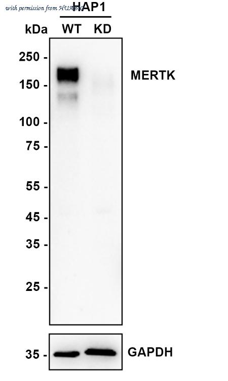 HUABIO ET1602-21 image 2