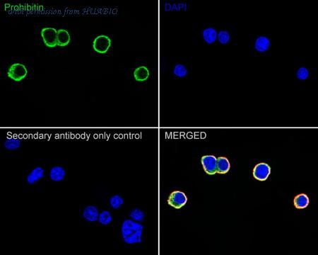 HUABIO ET1602-31 image 3