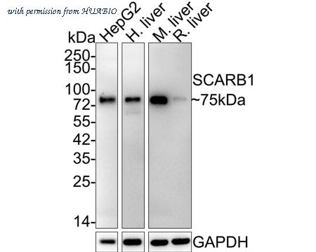 HUABIO ET1602-32 image 1