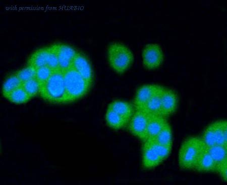 HUABIO ET1602-32 image 3