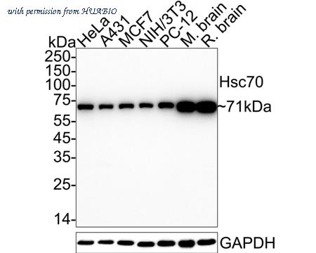 HUABIO ET1602-33 image 1