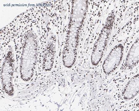 HUABIO ET1602-34 image 3