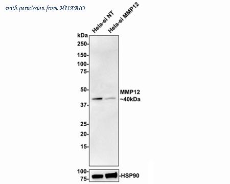 HUABIO ET1602-42-50UL image 2