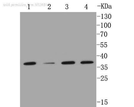 HUABIO ET1602-42-50UL image 3