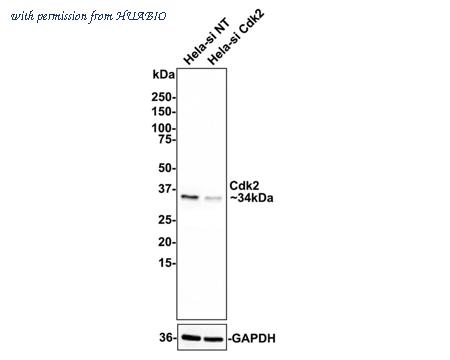 HUABIO ET1602-6 image 2
