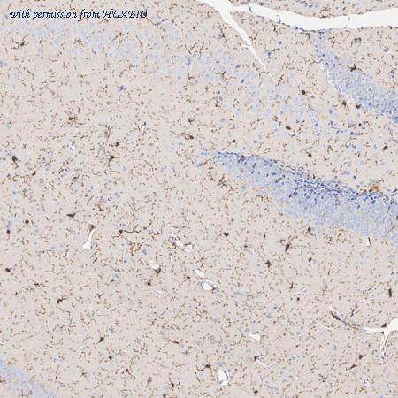 HUABIO ET1602-7 image 3