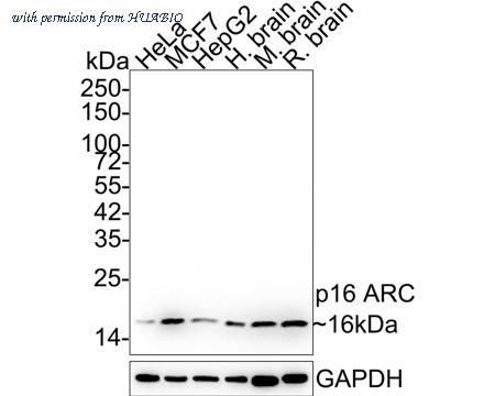 HUABIO ET1602-9 image 1