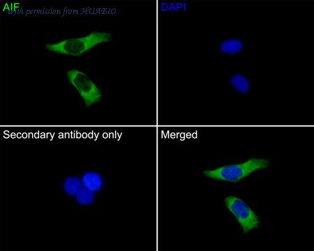HUABIO ET1603-4 image 3