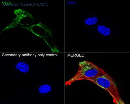 HUABIO ET1604-28-50UL image 1