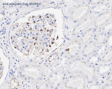 HUABIO ET1604-28-50UL image 3