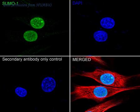 HUABIO ET1606-53 image 3