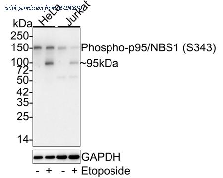 HUABIO ET1607-5 image 1