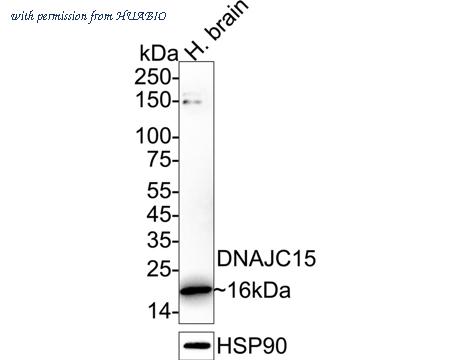 HUABIO ET1607-52 image 1