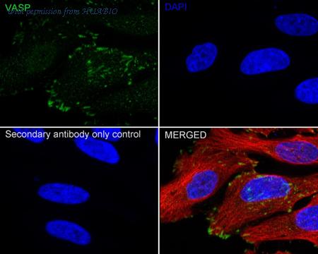 HUABIO ET1607-6 image 3