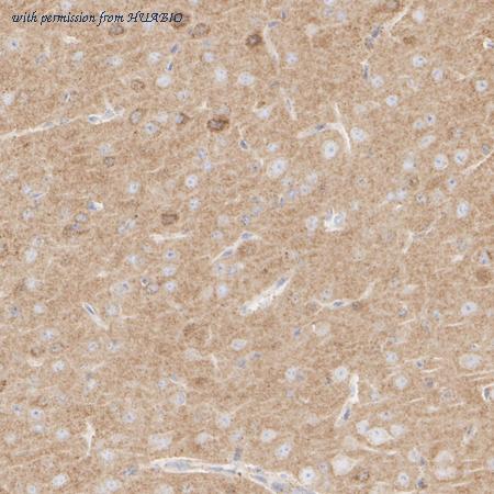 HUABIO ET1607-74 image 2