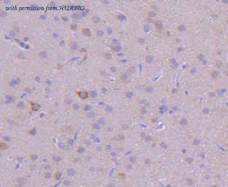 HUABIO ET1607-74 image 3