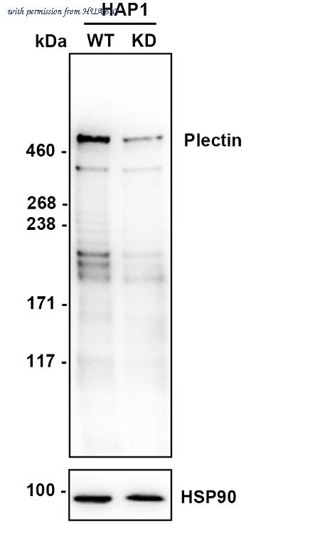 HUABIO ET1607-80 image 1
