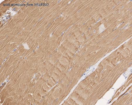 HUABIO ET1607-80 image 2