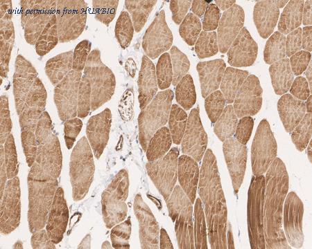 HUABIO ET1607-80 image 3