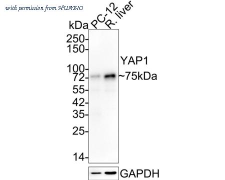 HUABIO ET1608-30-50UL image 2