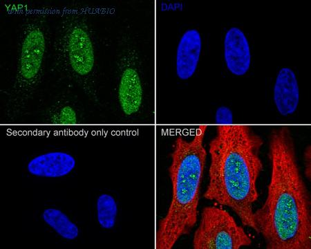 HUABIO ET1608-30-50UL image 3