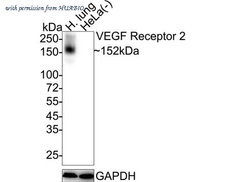 HUABIO ET1608-33 image 1