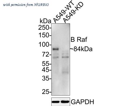 HUABIO ET1608-36 image 1