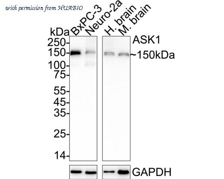 HUABIO ET1608-54 image 1