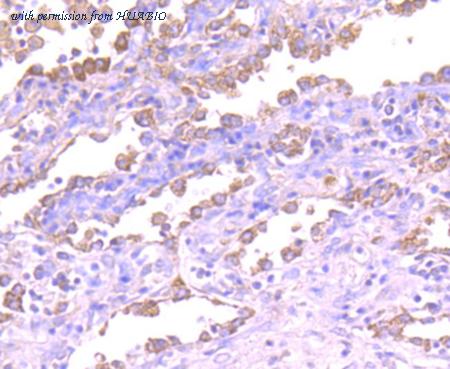 HUABIO ET1608-54 image 2