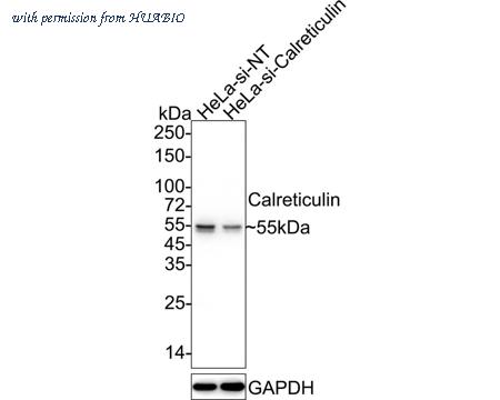 HUABIO ET1608-60-50UL image 3
