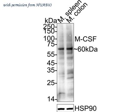 HUABIO ET1609-1 image 2